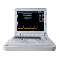 contec cms600p2plus portable ultrasound machine pseudo color doppler ultrasonic diagnostic system
