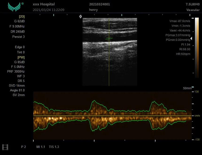 Ноутбук YD-P20 B/W ультразвуковая диагностическая система портативная цена