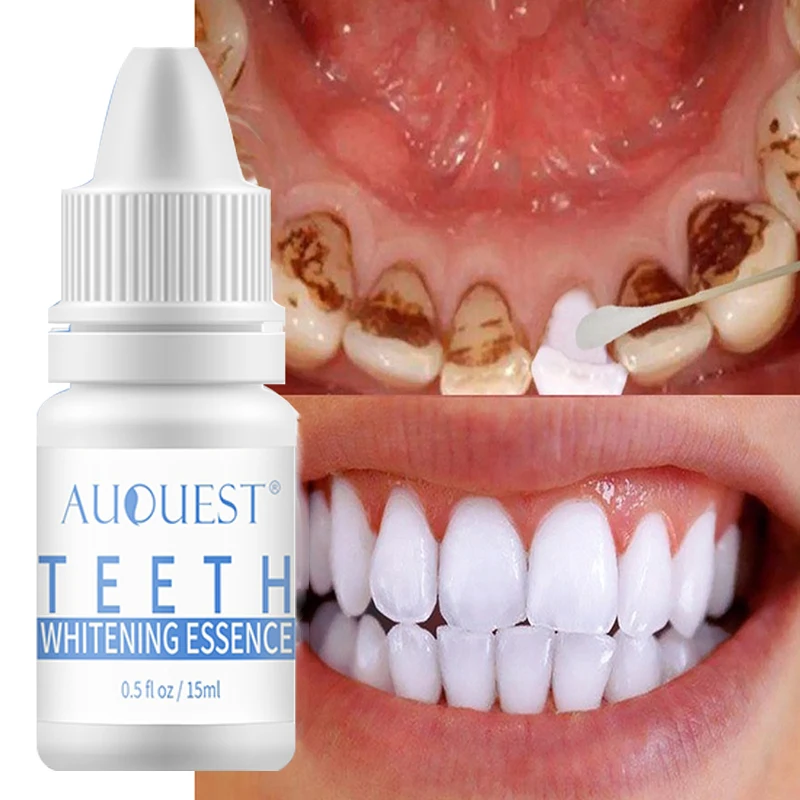 

Teeth Whitening Serum Dentistry Tools Bleach Oral Hygiene Cleansing Remove Plaque Stain Fresh Breath Teeth Whitener Dental Care