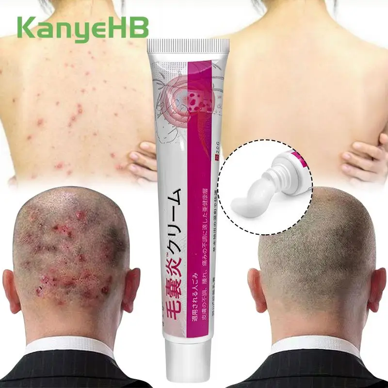 

1Pcs Herbal Acne Treatment Cream Folliculitis Eczema Rash Psoriasis Fungus Removal Skin Care Ointment Relieve Skin Itch S115