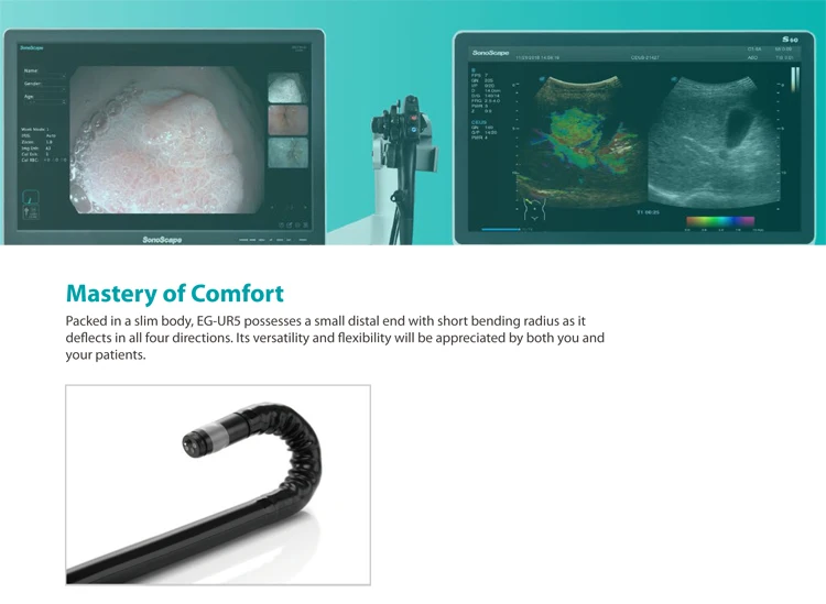 Соноскоп EUS 360 дюймов радиальный эхоендоскоп эндоскопический ультразвуковой