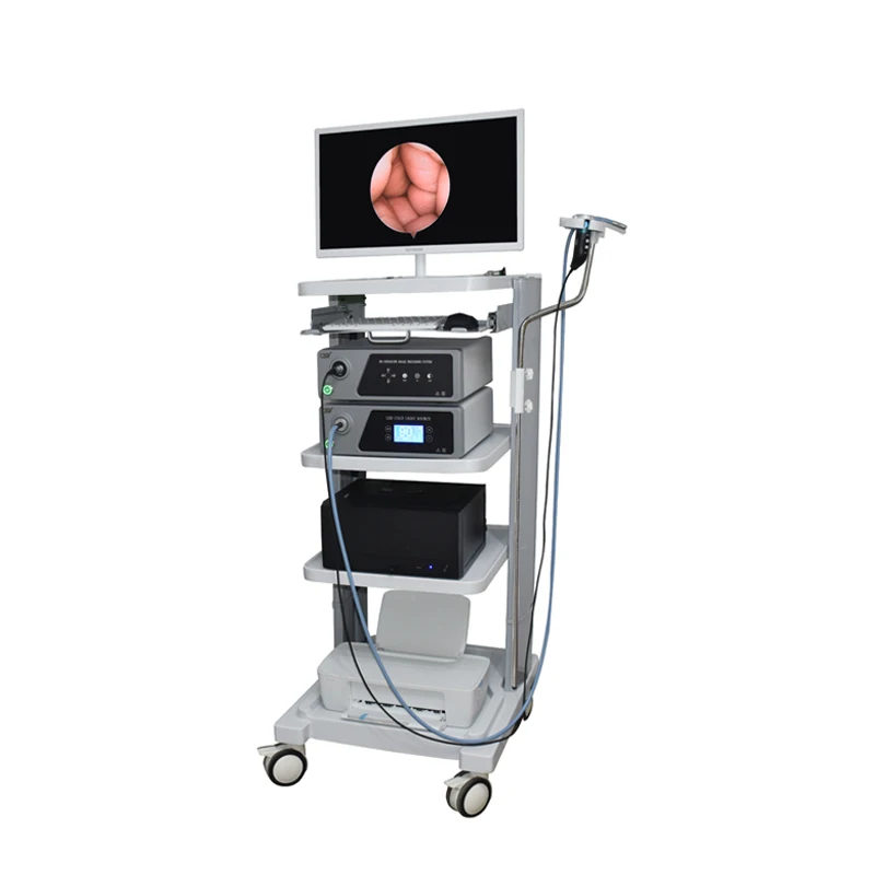 

professional full HD 1080p ent endoscopy