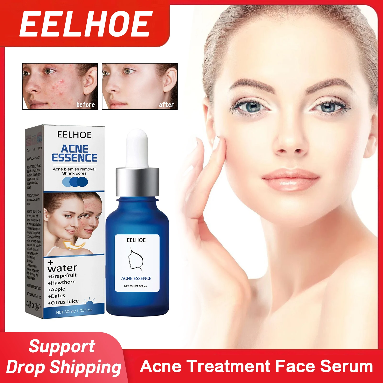 

Acne Treatment Face Serum Lighten Acne Marks Anti Pimple Oil Control Moisturizing Brighten Facial Skin Shrinking Pores Essence