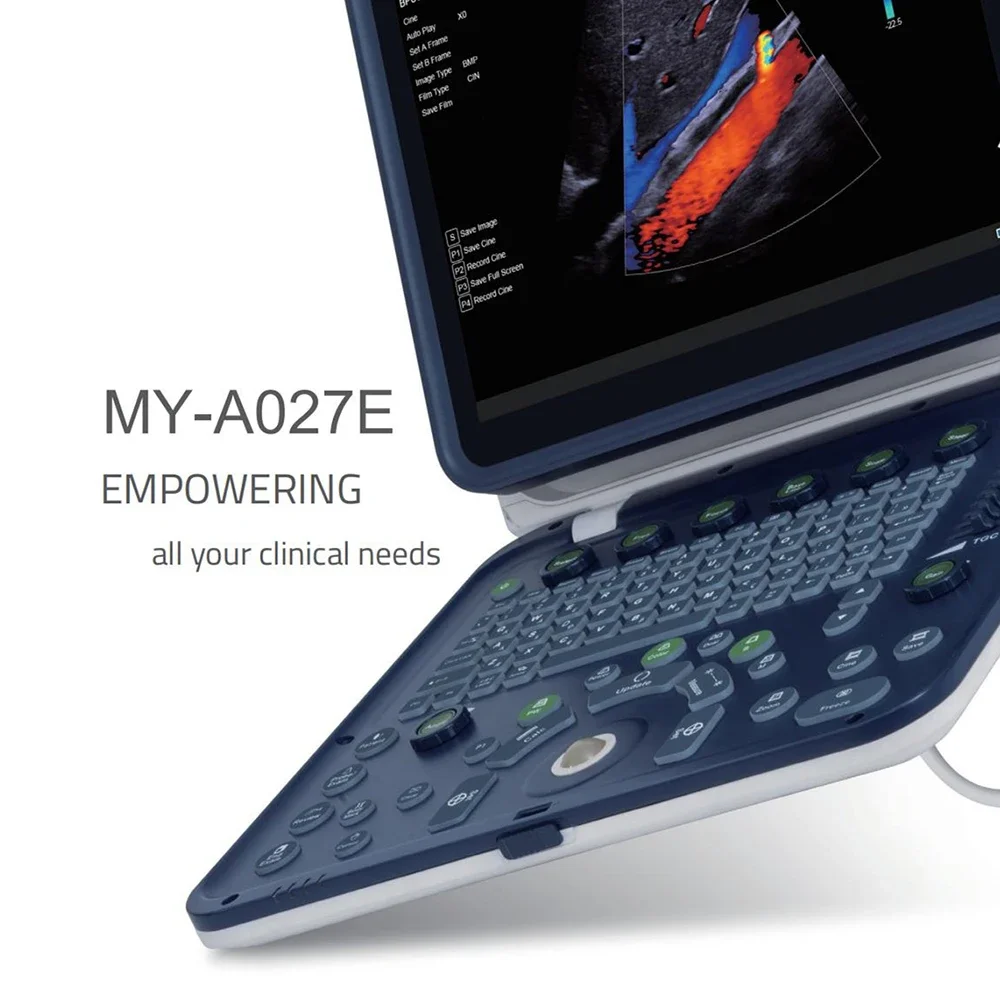 MY-A027E Mayamed портативный ноутбук ecografo ультразвуковой аппарат цветной Доплер сканер