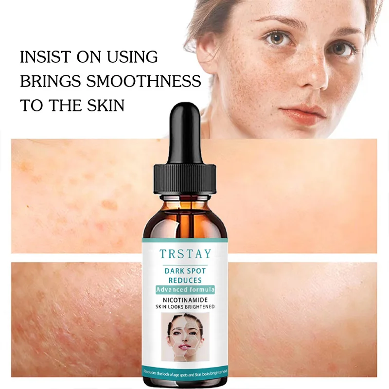 Усовершенствованная формула для снижения темных точек никотинамид кожа