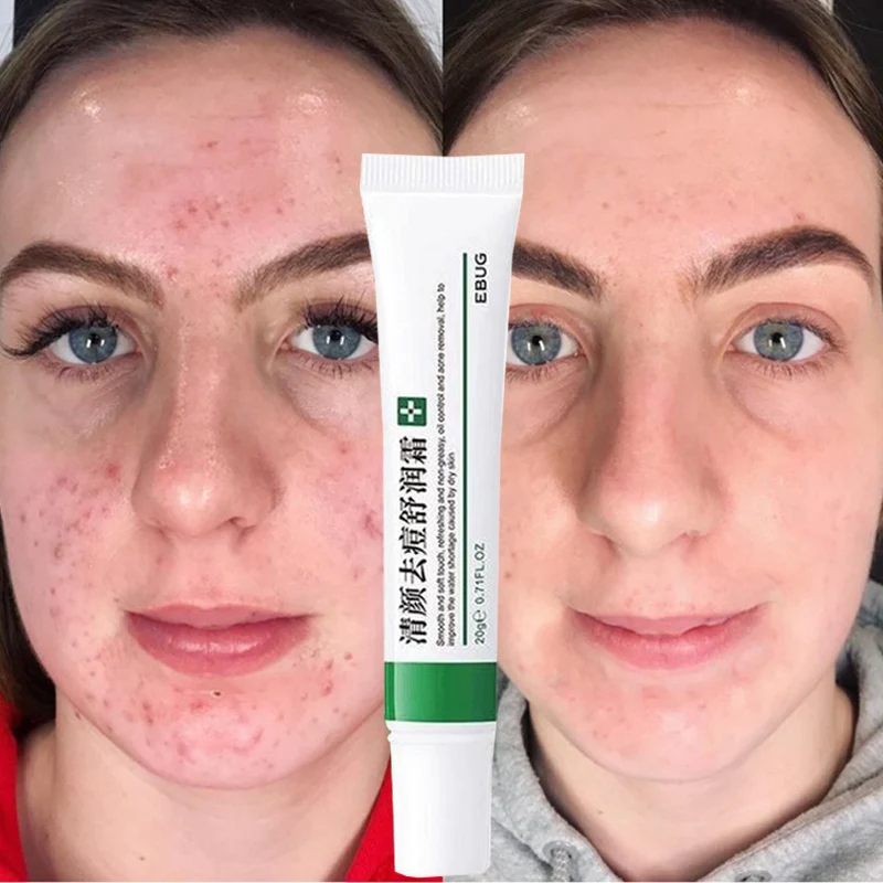 

1 шт. эффективное средство для ухода за кожей лица