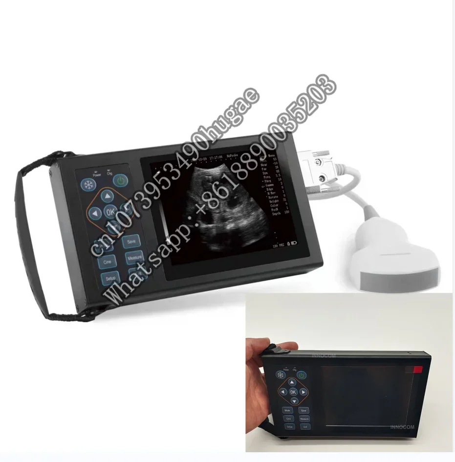 Zetop медицинский портативный ультразвуковой зонд инструменты ветеринарный