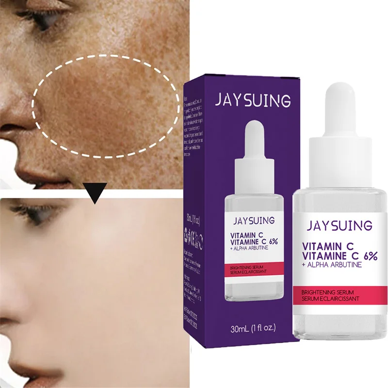 Vitamin C Whitening Face Serum Remove Dark Spot Fade Melasma Freckle Anti-Aging Brighten Moisturizing Skin Care Korean Cosmetics