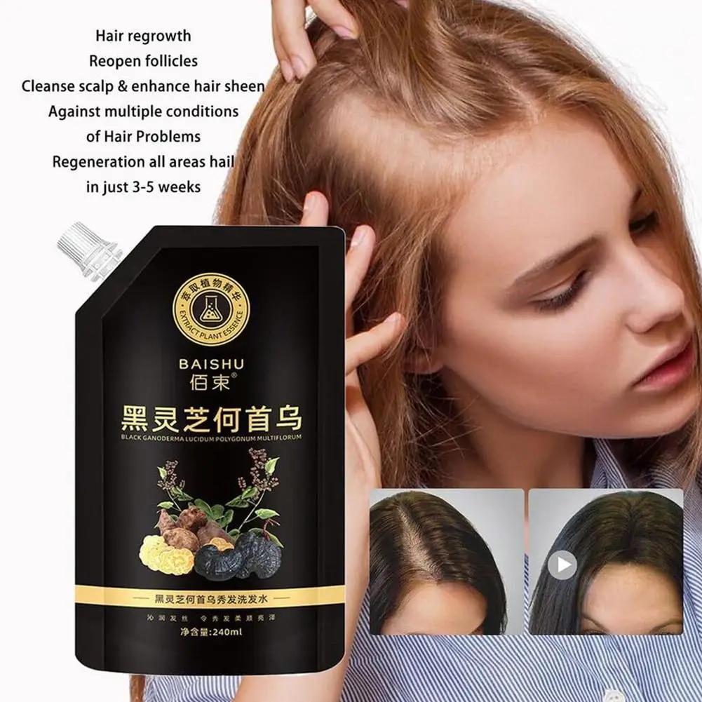 

Шампунь для волос Multiflorum He Shou Wu, 240 мл, натуральный шампунь против волос, гладкость, глубокое очищение, питание, выпадение волос R6S2