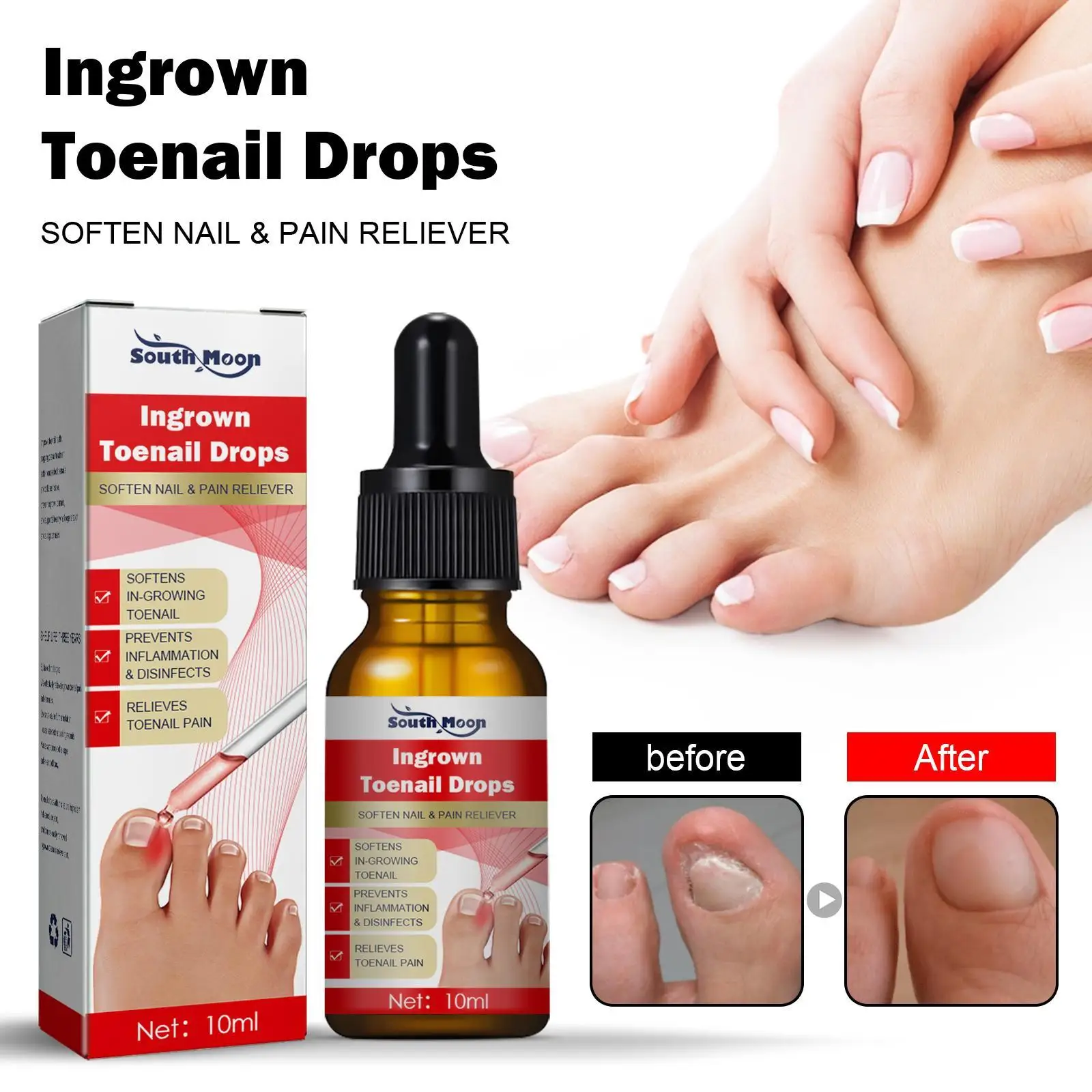 

10ml/20ml Ingrown Toenail Treatment Serum Nail Correction Recover Oil Pain Reliever Nail Softener Trim With Ease Oil Feet Health