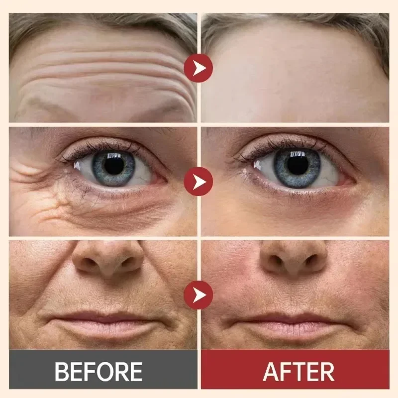 Капсулы с гиалуроновой кислотой сыворотка тонкими линиями против морщин