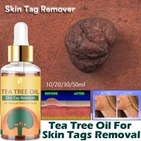 skin tag remover genital wart treatment instant removal molepapillomas foot corn repair tool natural bacteriostatic liquid