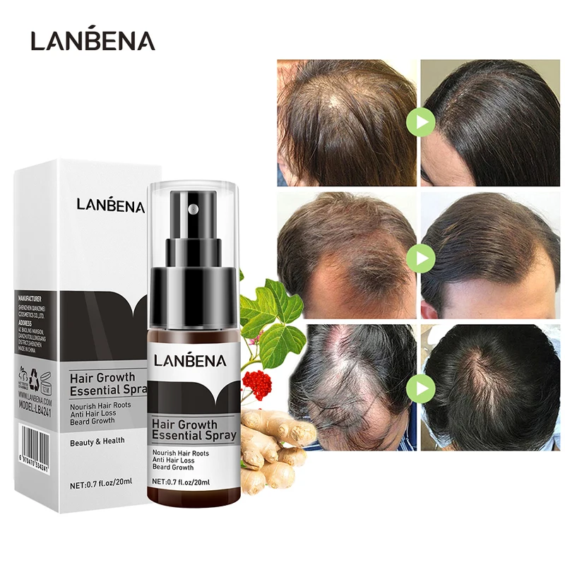 LANBENA Anti-Hair Loss Growth Essence Spray Nourishes Scalp Hair Root Ginger Extract Treats Damaged Hair Products Hair Care 20ML