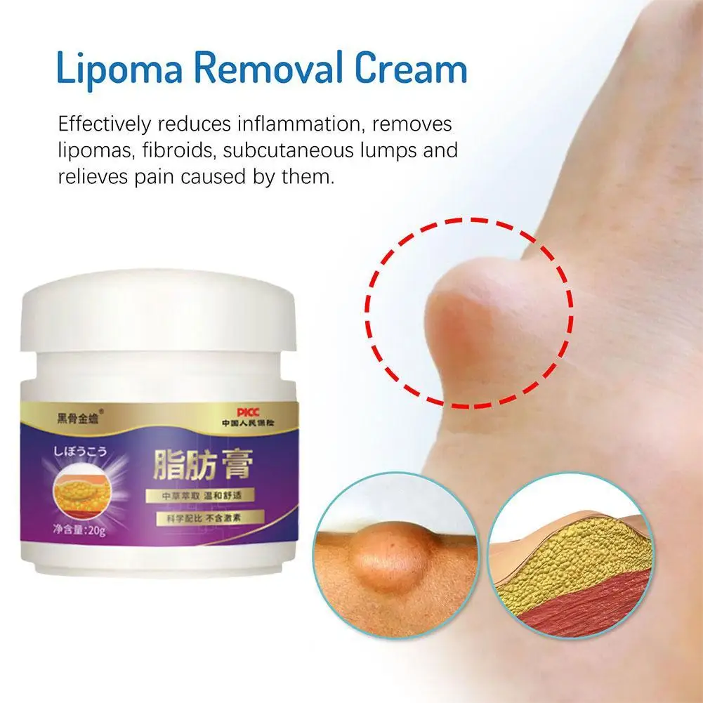 

1pcs Lipoma Removal Cream Fatty Tumor Ointment Sp ecialized Chinese Medicine Eliminate Lumps Multiple Genuine Skincare Products