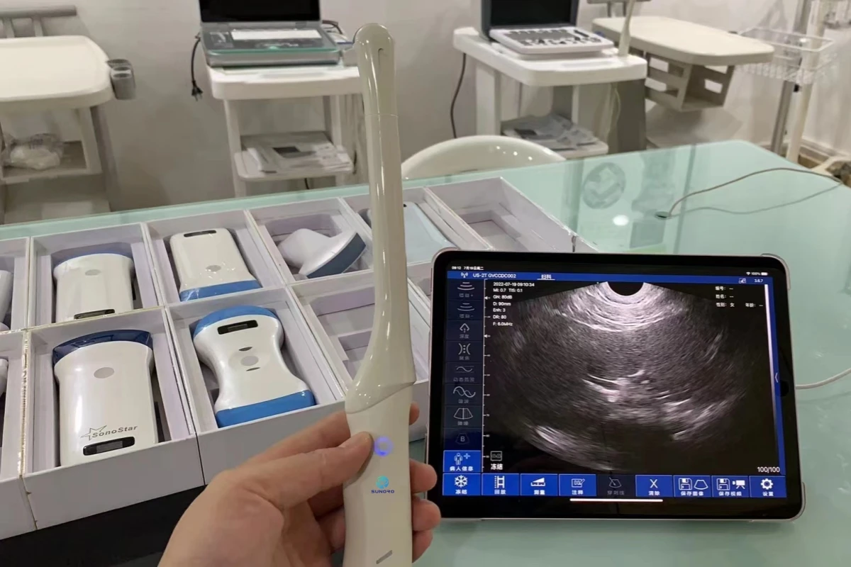 Клиника и больница. Портативный беспроводной интеллектуальный ультразвуковой