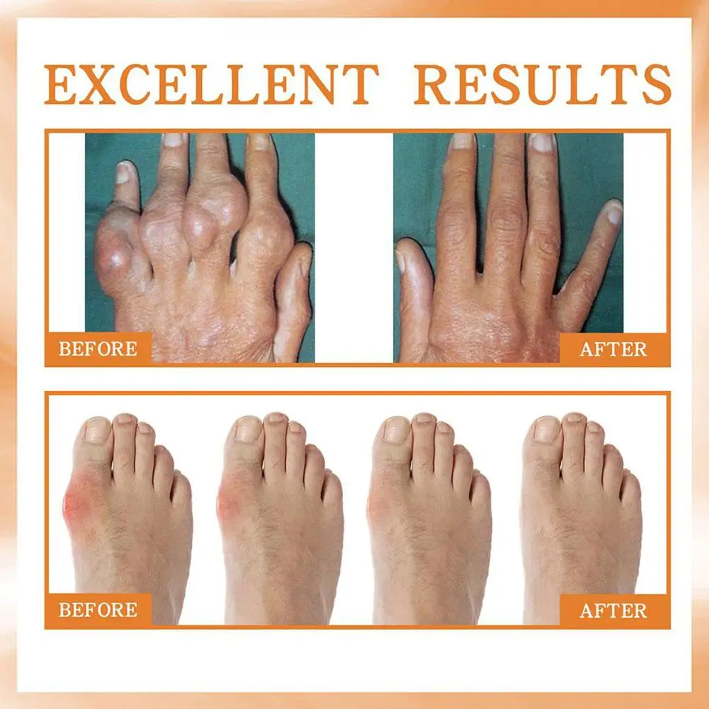 Спрей для лечения суставов и костей 60 мл