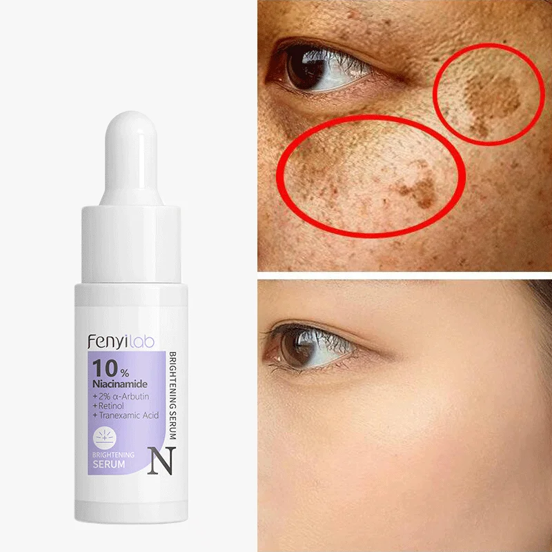 

Nicotinamide Whitening Freckle Removing Essence Remove Dark Spots Brighten Lighten Skin Oil Control Moisturizing Anti-aging Skin