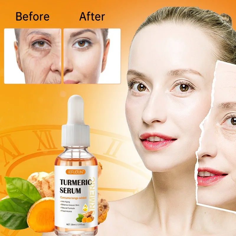 

Turmeric Freckle Whitening Serum Curcumin Oil Brighten Fade Dark Spot Removal Pigment Melanin Correcting Beauty Face Skin Care