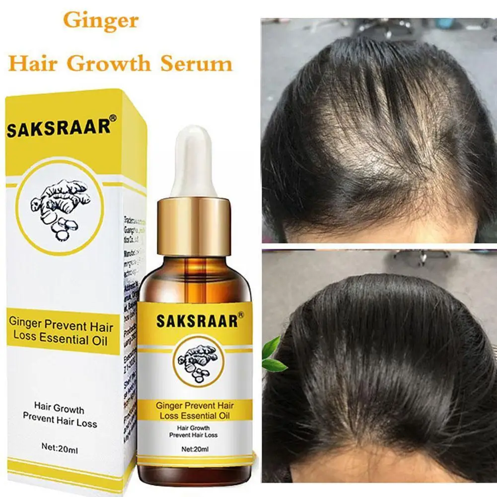 Ginger Hair Growth Essential Oil Products Fast Growing Hair Beauty Hair Care Prevent Hair Loss Oil Scalp Treatment For Men X0H3