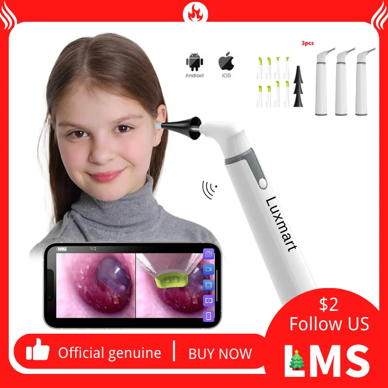 Беспроводной отоскоп 10шт 3