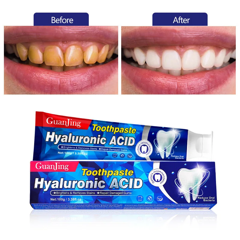 

Deep Cleaning Toothpaste Hyaluronic Acid Toothpaste for Whiter Teeth Restorative Toothpaste Relieve Gum and Soft Tissue Problems