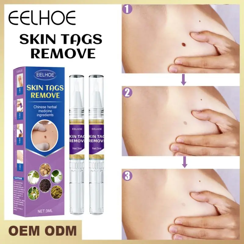 

EELHOE Skin Tag Remover Against Moles Removal Genital Wart Acne Spot Treatments Anti Foot Corn Skin Care Wart Liquid Remover
