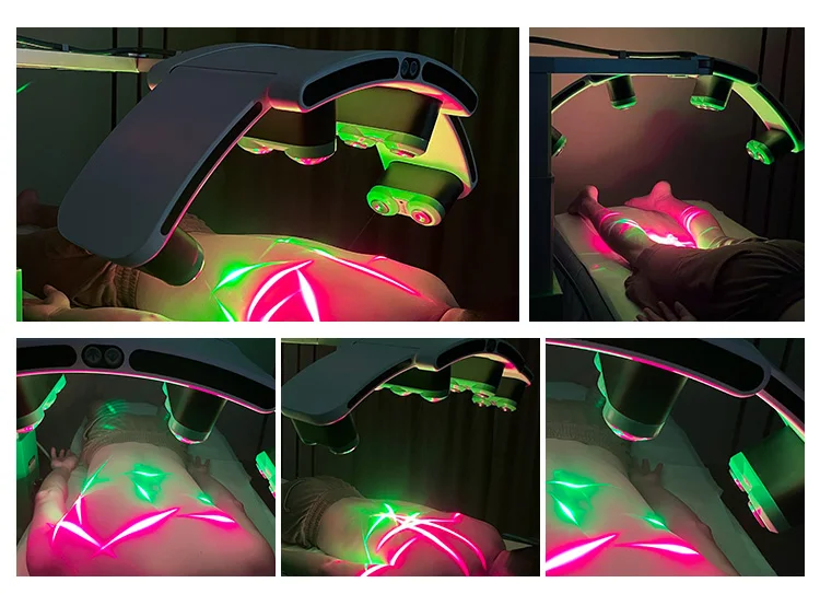 Профессиональный Изумрудный Лазерный Аппарат Maxlipo 10D для безболезненного