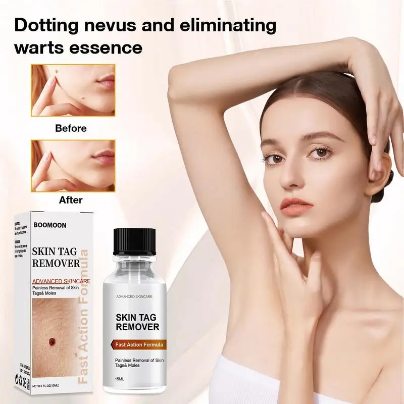 

Skin Tag Remover 15ml Promote Skin Repair Moisturizing Dark Spot Essence Remove Wart Mole Pigment Cleansing Skin accessories