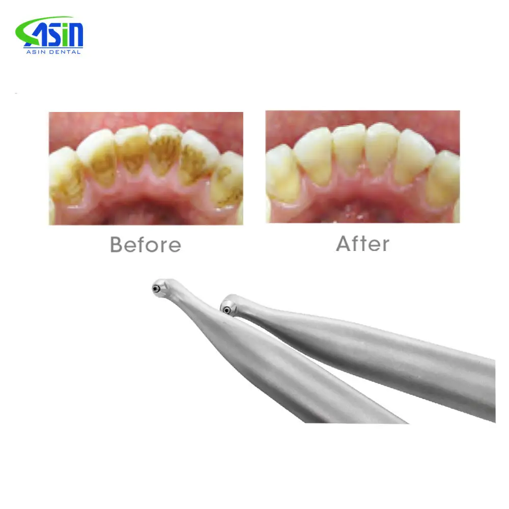 Система воздушной полировки Air Prophy Sander g un Дешевая цена Den tal Алюминиевый сплав 2/4