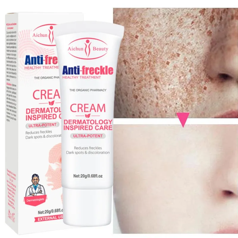 

Nicotinamide Whitening Freckle Cream Remove Dark Spots Melanin Melasma Brighten Face Pigmentation Anti-Aging Skin Care Cosmetics