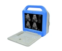2022 hot sales high frequency diagnostic instruments portable digital laptop ultrasound machine