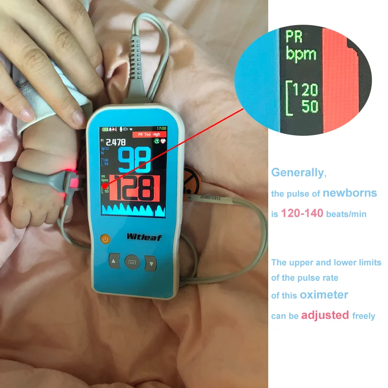 

Baby Handheld Pulse Oximeter Portable Medical Adult Newborn Infant Child Kids Heart Rate Monitor Neonate SpO2 PR Rechargeable