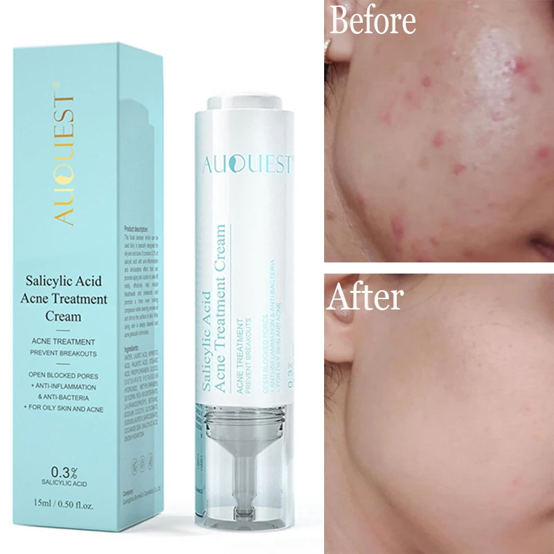 

15ML Blackhead Remove Face Serum Acne Treatment Shrink Pores Oil Control Acid Salicylic Gel Whitening Repair Acne Skin Care Tool