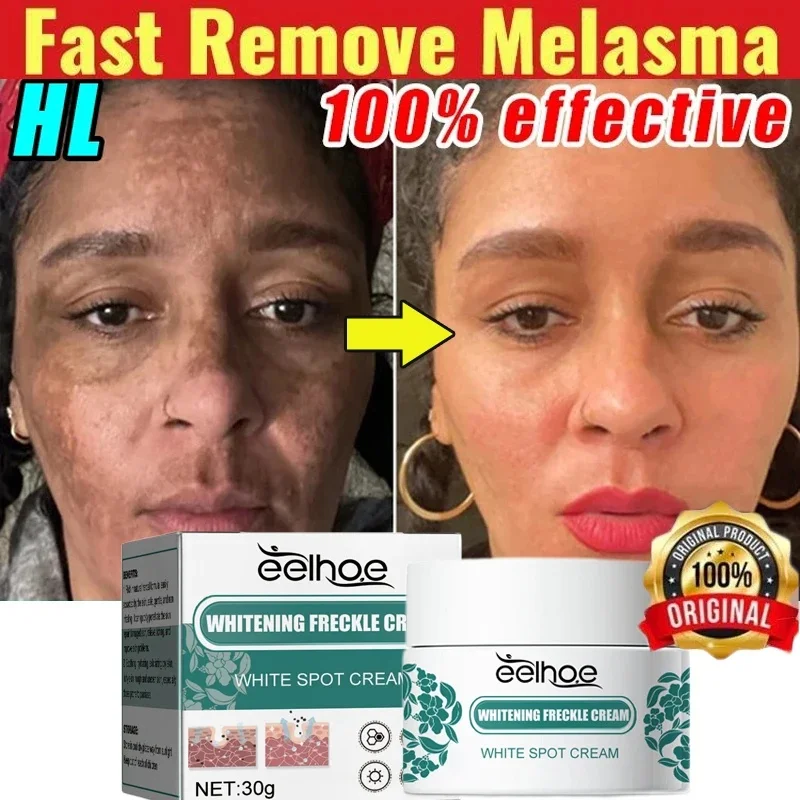 Niacinamide мелазма Осветляющий крем уменьшает меланин осветляет темную кожу хлоазма