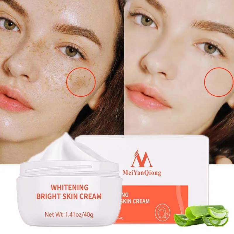 

Powerful Whitening Freckle Cream Remove Acne Spots Melanin Dark Spots Face Lift Firming Face Skin Care Beauty Essentials