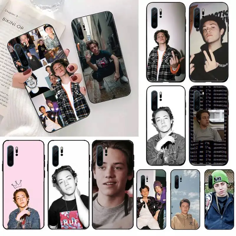 

Carl Shameless actor Phone Case For Huawei honor Mate 10 20 30 40 i 9 8 pro x Lite P smart 2019 Y5 2018 nova 5t