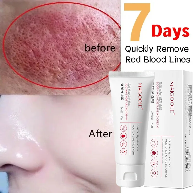 

Facial Redness Repair Cream Improve Sensitive Skin Redness Rosacea Itching Anti Aging Moisturizer Sooth Korean Care Cosmetics