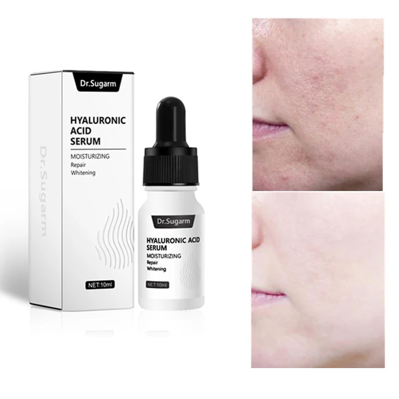 

1PCS Face Serum Hyaluronic Acid Whiten Lighten Facial Skin Essence Improve Dull Firming Skin Shrink Pores Essence Cosmetics