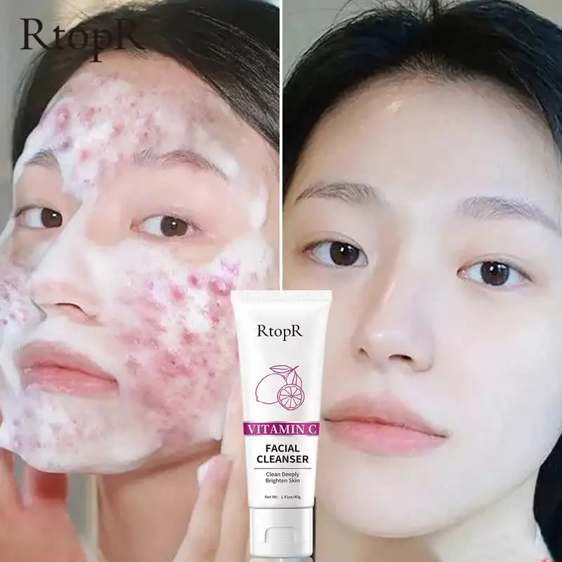 

Cleansing Facial Cream Whitening and Acne Repairing Skin Brightening Facial Care Exfoliating Oil Removal Teen Skin care