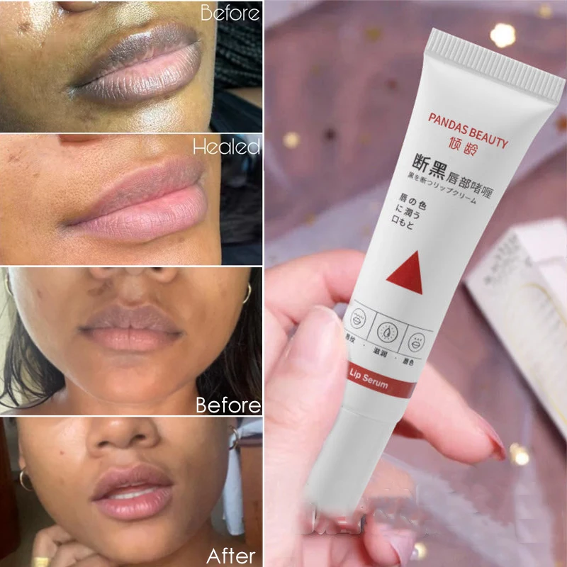 

Naturally Lighten Dark Lips Fast Lip Lightening Serum for Fading Lip Lines Brightening Lip Skin Reduce Pigmentation Lip Balm