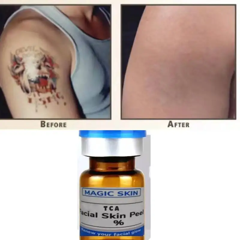 

Tca Chemical Peel for Tattoo Pharmaceutical Medical Grade