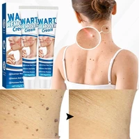 skin tag removal cream removal essential oils painless mole wart removal skin melasma serum freckles facial wart tag treatment