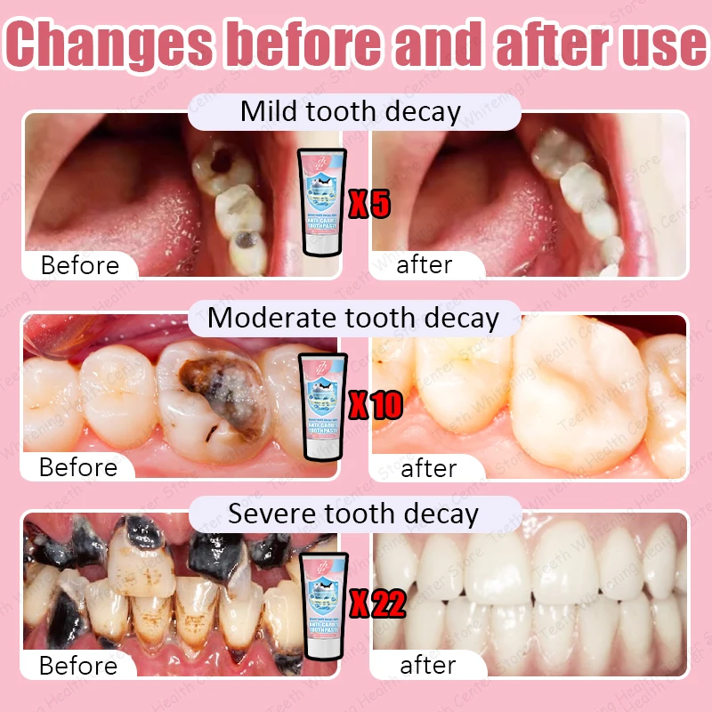 99 9% Teknik sazi azi אור