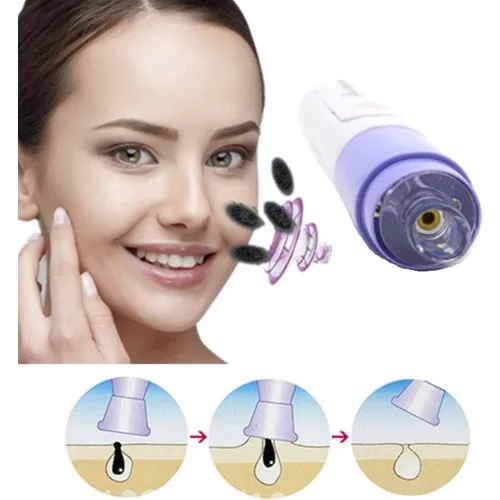 Девиз вакуумное средство для удаления черных точек очиститель пор с