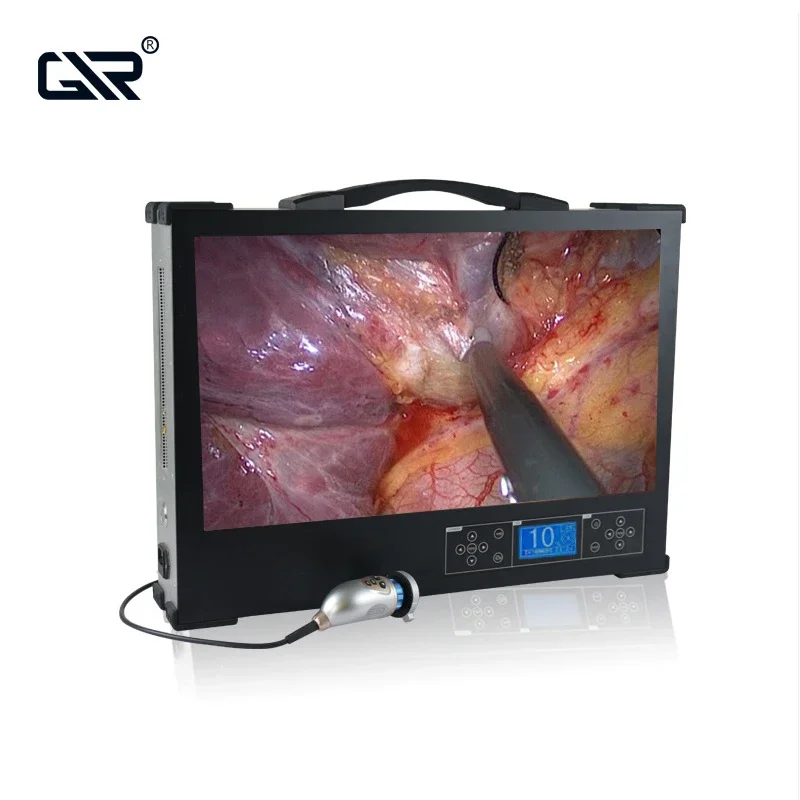 24-дюймовый медицинский встроенный эндоскоп ультразвуковое и электронное