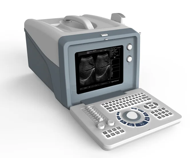 

SS-5 низкая цена, черно-белая медицинская ультразвуковая машина, медицинские ультразвуковые инструменты