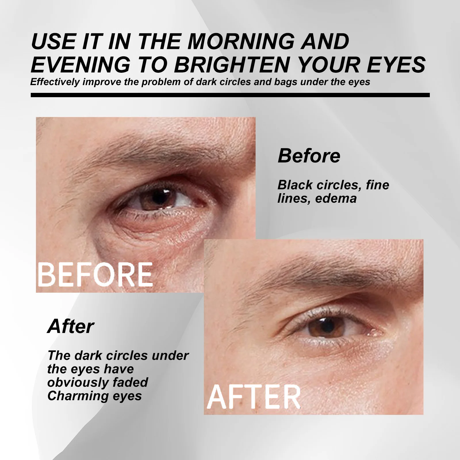 Рисунок 4 - Ролик для области вокруг глаз от