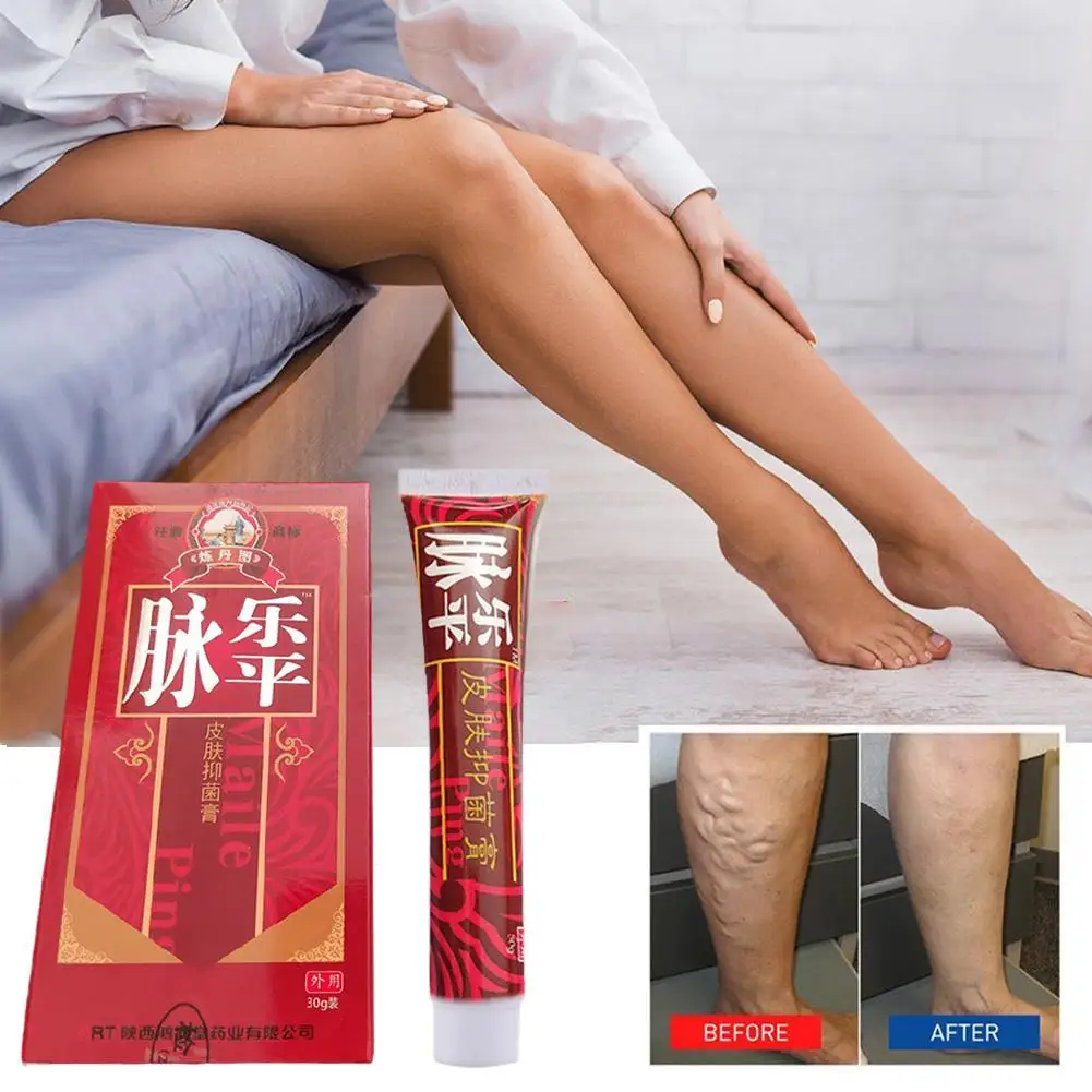 

20g Herbal Effective Varicose Vein Relief Cream Eliminate Vasculitis Phlebitis Legs Treatment Soothing Relieve Pain Ointment