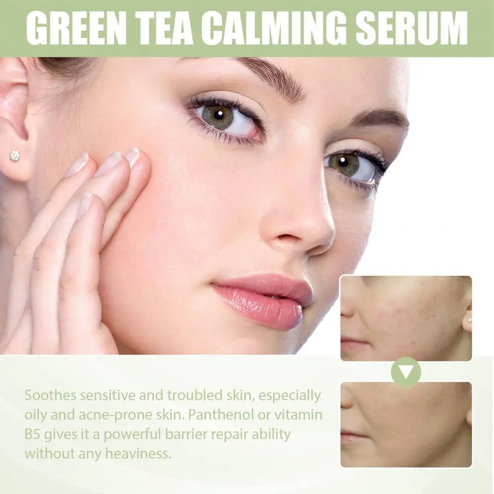 

Natural 30ml Safe Repairing Sensitive Skin Liquid No Residue Facial Lotion Green Tea Extract for Unisex