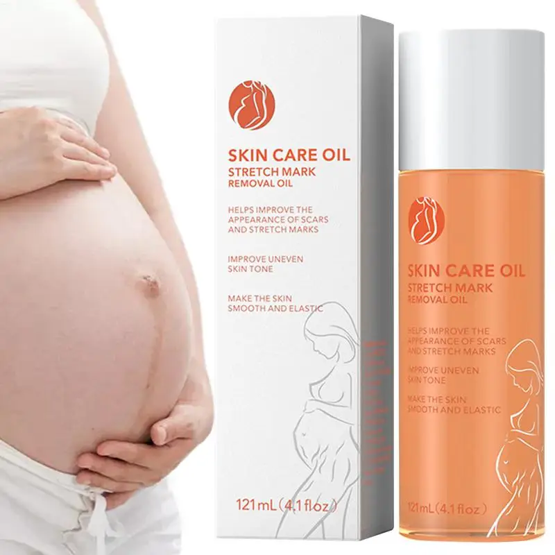 

Stretch Mark Pregnancy Massage Oil Plant Extracts Prevent Fade Stretch Marks Almond Oil For Skin Alternative To Stretch Mark